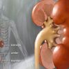 Kidney Failure – Causes, Prevention and Diet