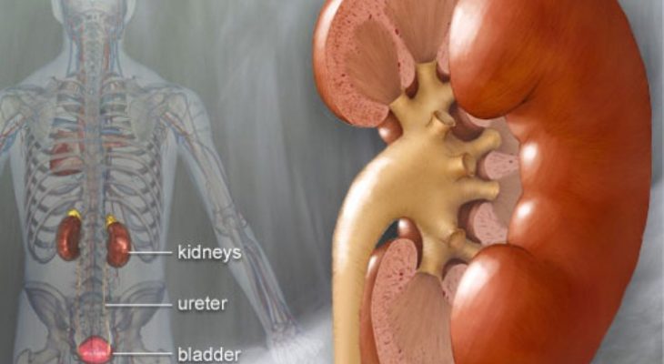 Kidney Failure – Causes, Prevention and Diet